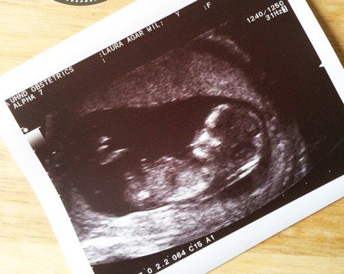 12 Weeks Pregnant: 12 week scan + 1st Trimester Style